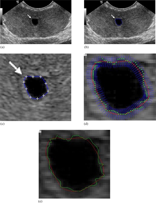 Figure 14