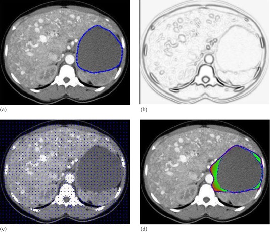 Figure 15