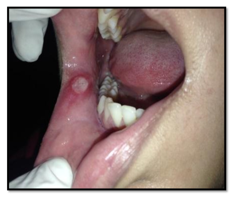 Fig. (2)