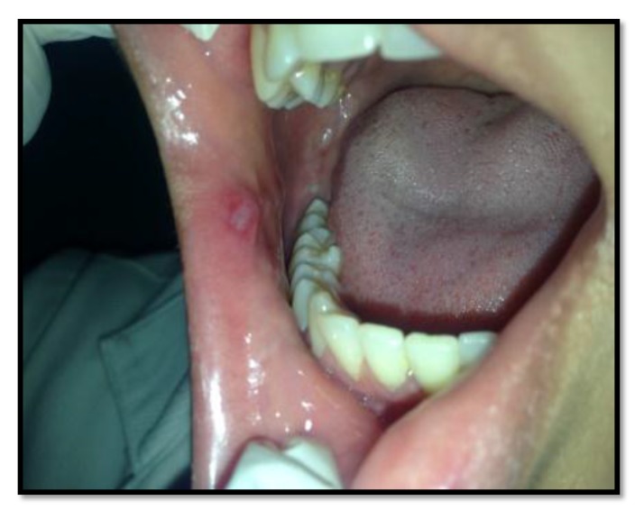 Fig. (3)