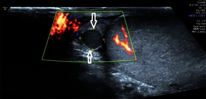 Fig. 13