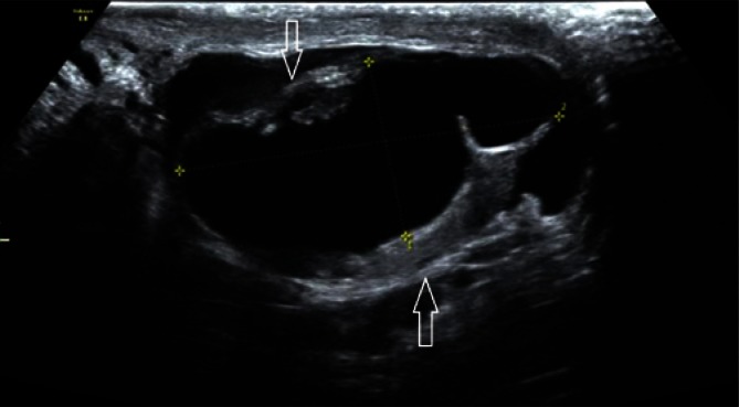 Fig. 11