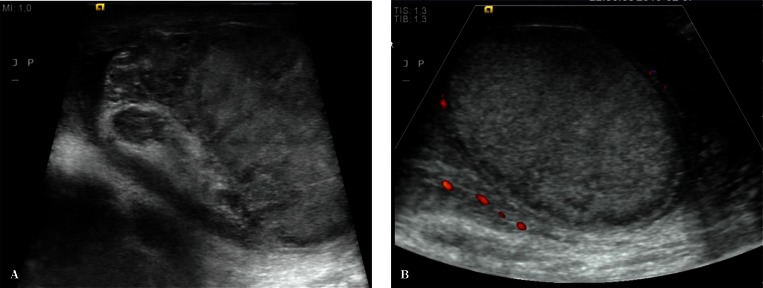 Fig. 17