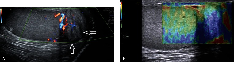 Fig. 14