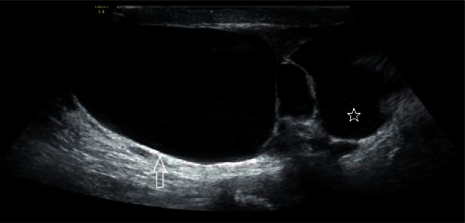 Fig. 12