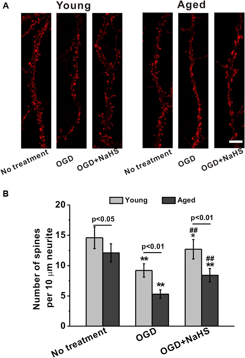 FIGURE 3