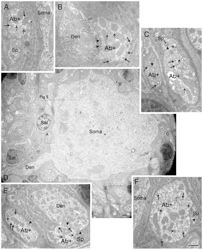 FIGURE 4