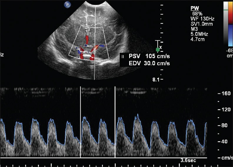 Figure 19