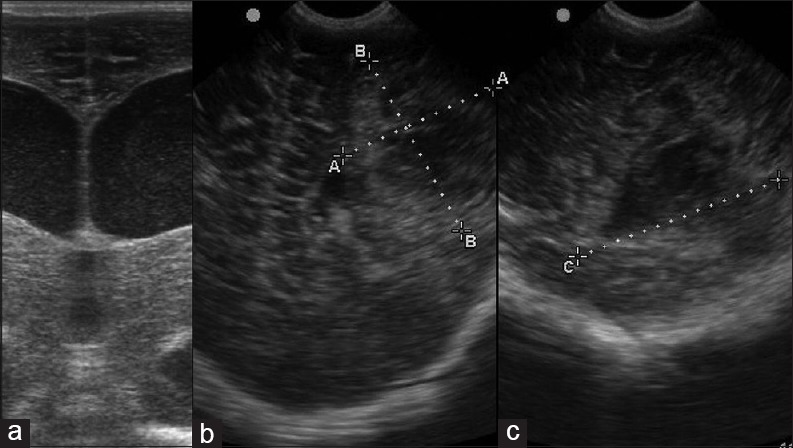 Figure 14