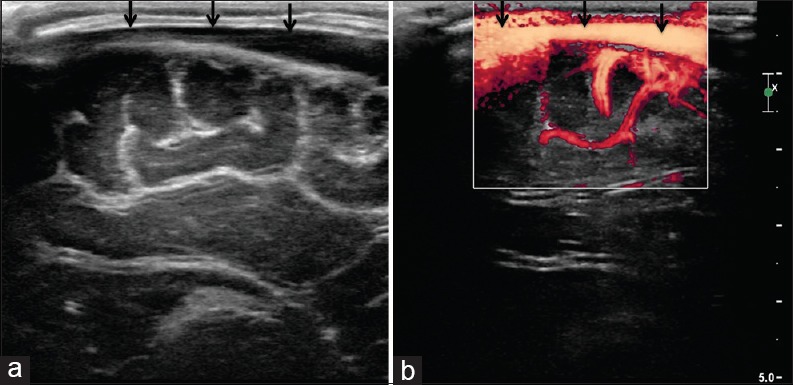 Figure 16