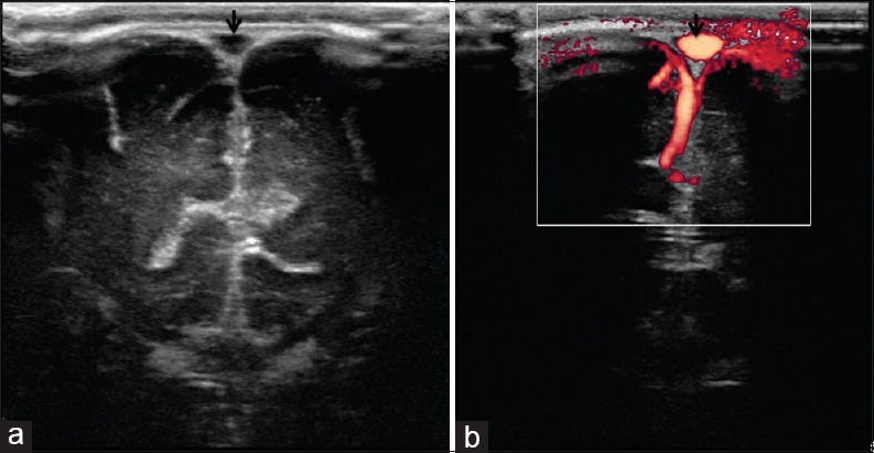 Figure 17