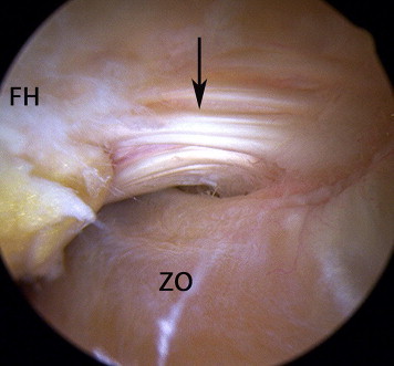 Fig 3