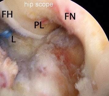 Fig 5