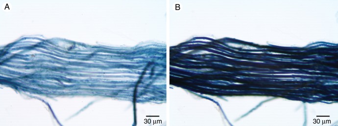 Fig. 11.