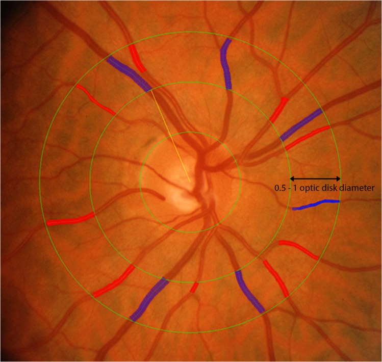 Fig 1