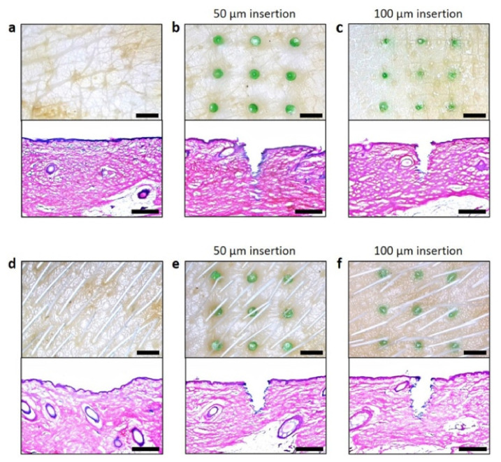 Figure 17