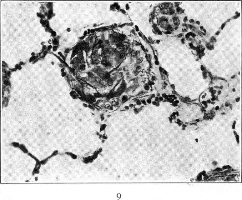 Fig. 9