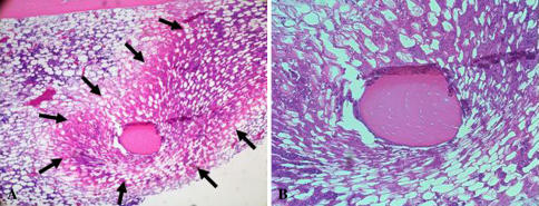 Fig. 2A–B