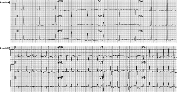 FIGURE 2