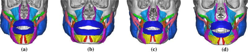 Fig. 11