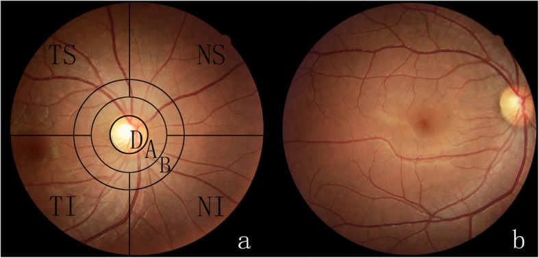 Fig. 2