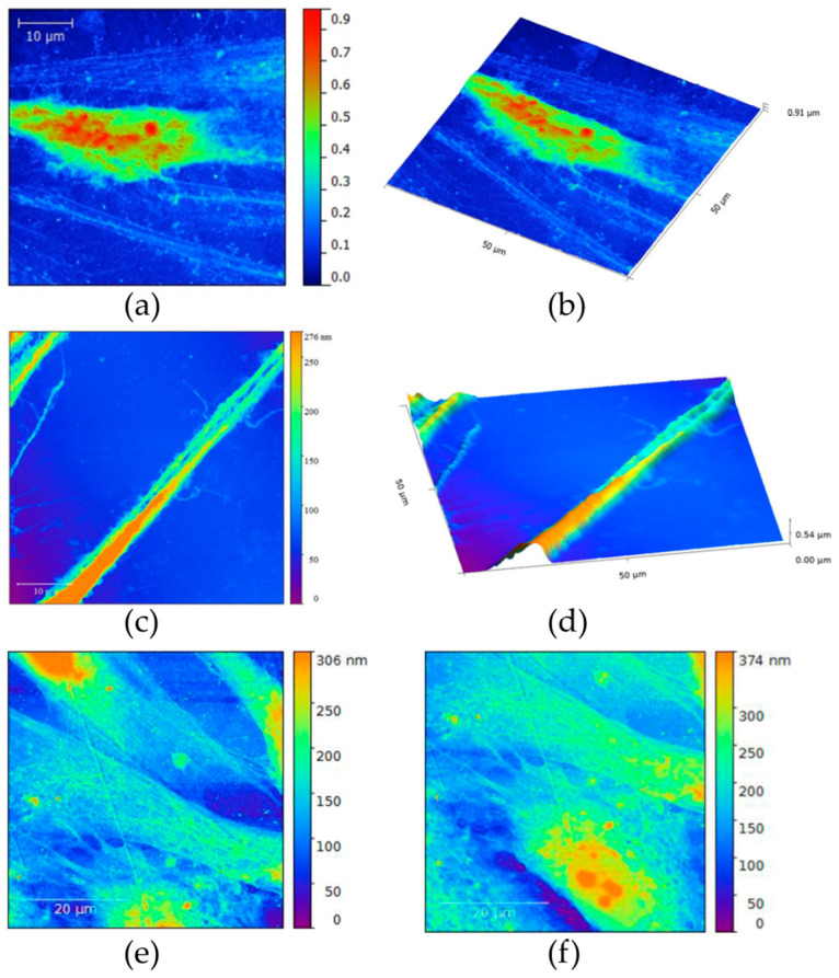 Figure 11