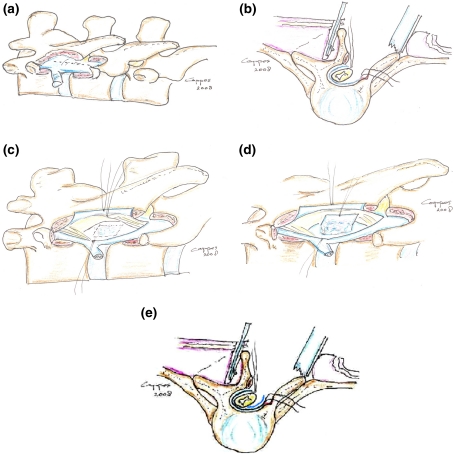 Fig. 1