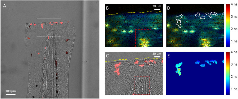 Light Sheet Autofluorescence Lifetime Imaging With A Single Photon 