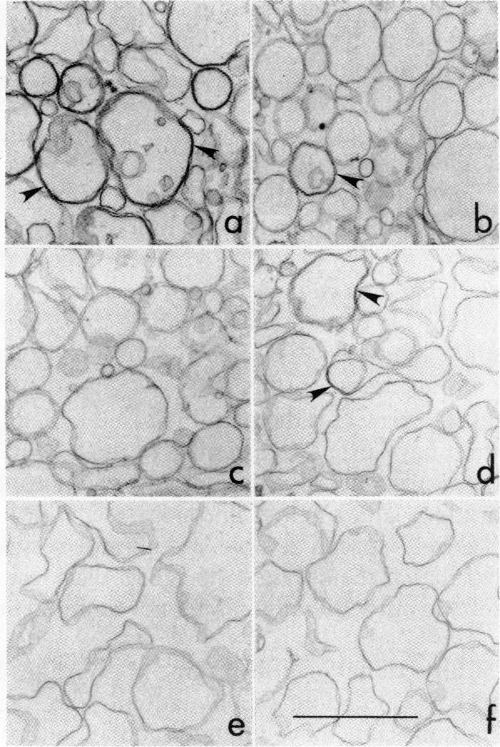 graphic file with name pnas00657-0336-a.jpg