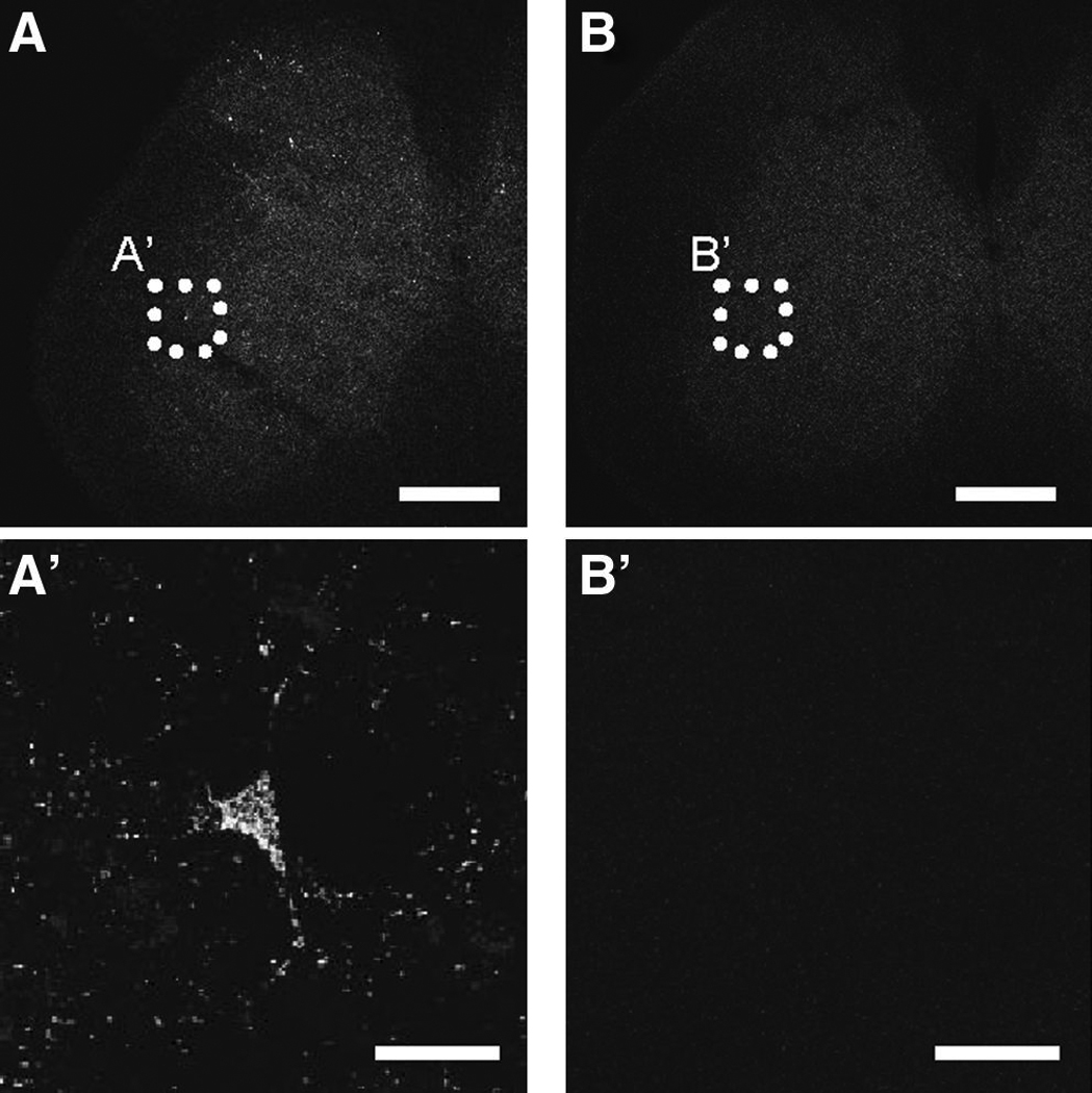 FIG. 4