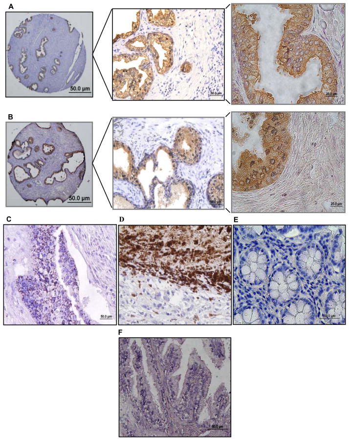 FIG. 6