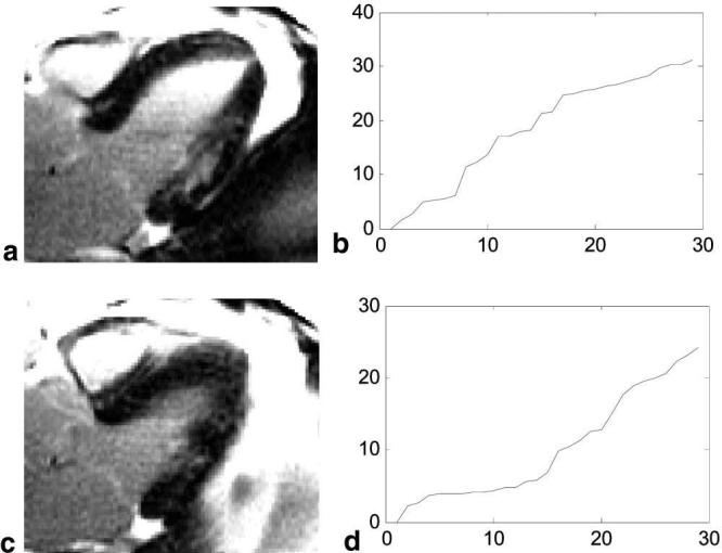 FIG. 6