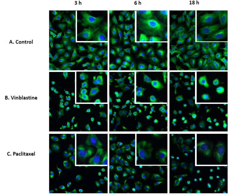 Fig. (1)