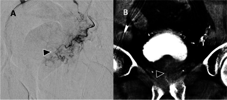 Fig. 2