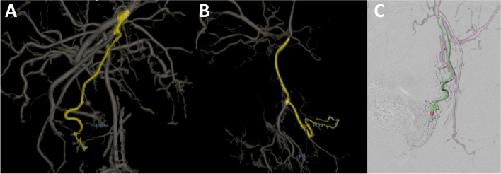 Fig. 1