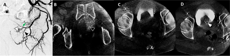 Fig. 4