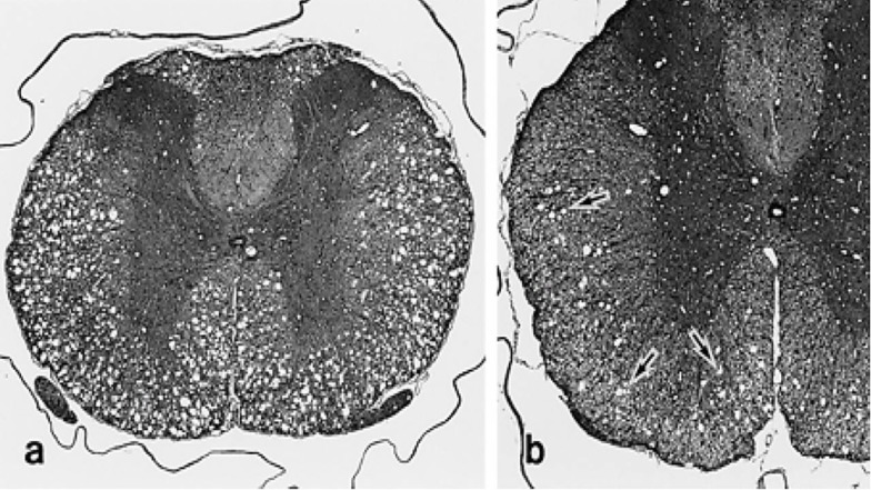 Fig. (3)