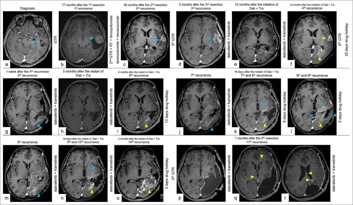 Figure 3: