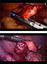 graphic file with name 464_2018_6121_Figbf_HTML.jpg