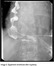 graphic file with name 464_2018_6121_Figdu_HTML.jpg