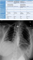 graphic file with name 464_2018_6121_Figcu_HTML.jpg