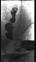 graphic file with name 464_2018_6121_Figaw_HTML.jpg