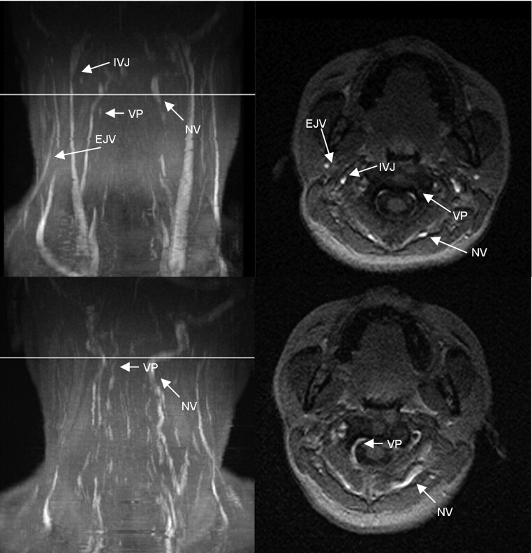 Fig 2.