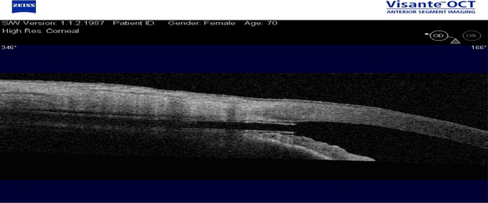 Fig. 10