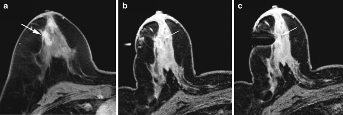 Fig. 3a–c