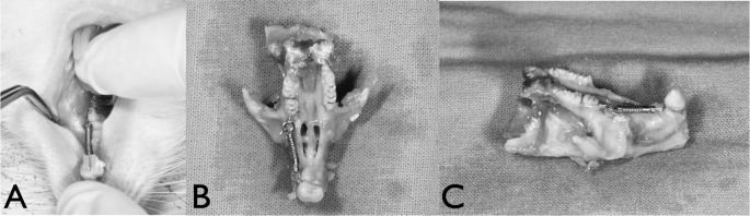 Figure 1. Appliances used for molar protraction. (A) Intraoral view. (B) Occlusal view. (C) Lateral view.