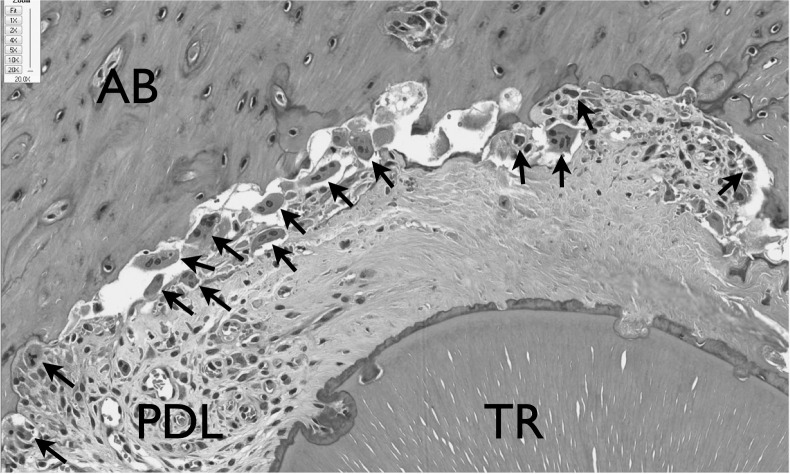 Figure 4. Osteoclasts were morphologically identified as large multinucleated cells on H&E staining. AB indicates alveolar bone; PDL, periodontal ligament; and TR, tooth root. Arrows: osteoclasts.