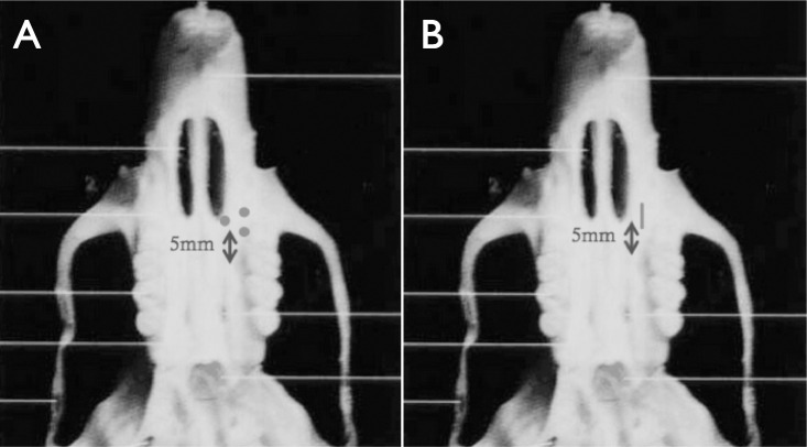 Figure 2. (A) Schematic of micro-osteoperforation and (B) corticision.