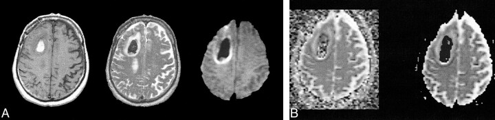 fig 3.