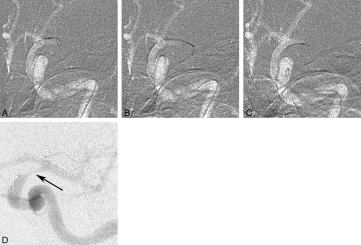 Fig 1.